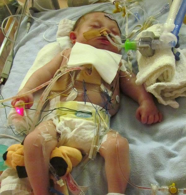 Liam as a newborn in the NICU, surrounded by monitoring equipment, with a small stuffed dog tucked beside him
